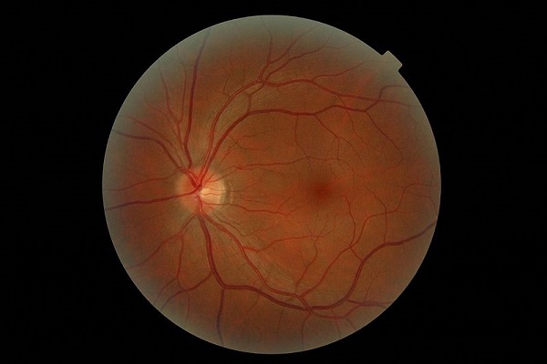 retina - quantum vision